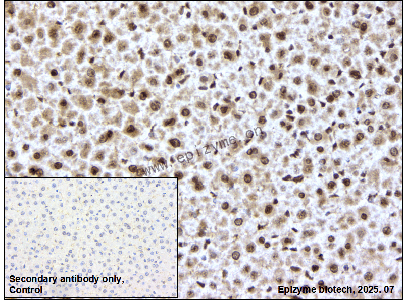 Anti-Cyclophilin B Rabbit mAb [46M55K99]