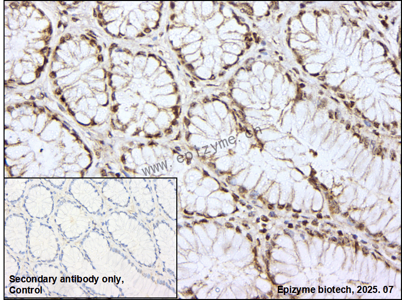 Anti-Cyclophilin B Rabbit mAb [46M55K99]