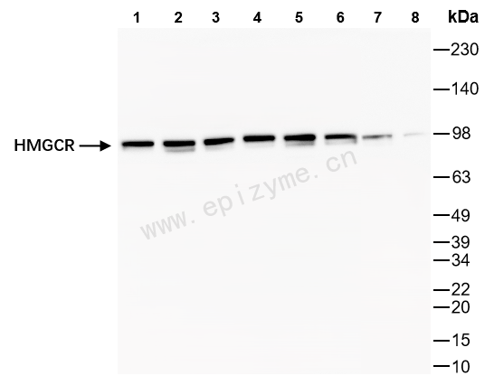Anti-HMGCR Rabbit mAb [93L33K48]