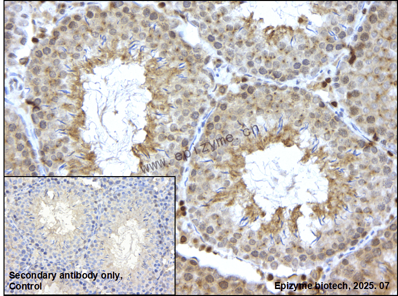Anti-HMGCR Rabbit mAb [93L33K48]