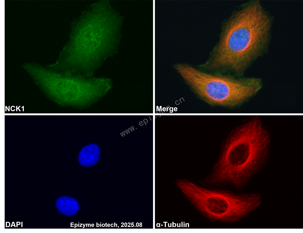 Anti-NCK1 Rabbit mAb [22M50K33]