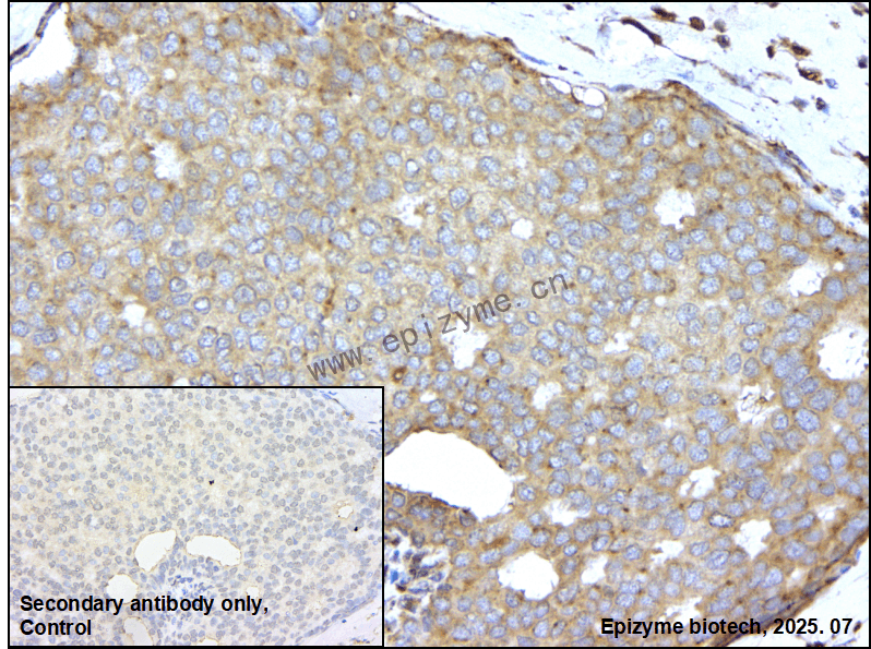 Anti-NCK1 Rabbit mAb [22M50K33]