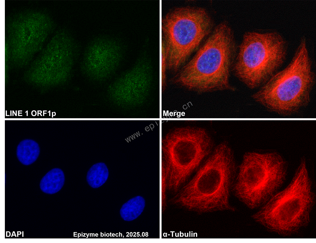 Anti-LINE 1 ORF1p Rabbit mAb [75K85K22]