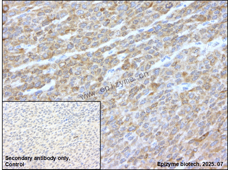 Anti-LINE 1 ORF1p Rabbit mAb [75K85K22]