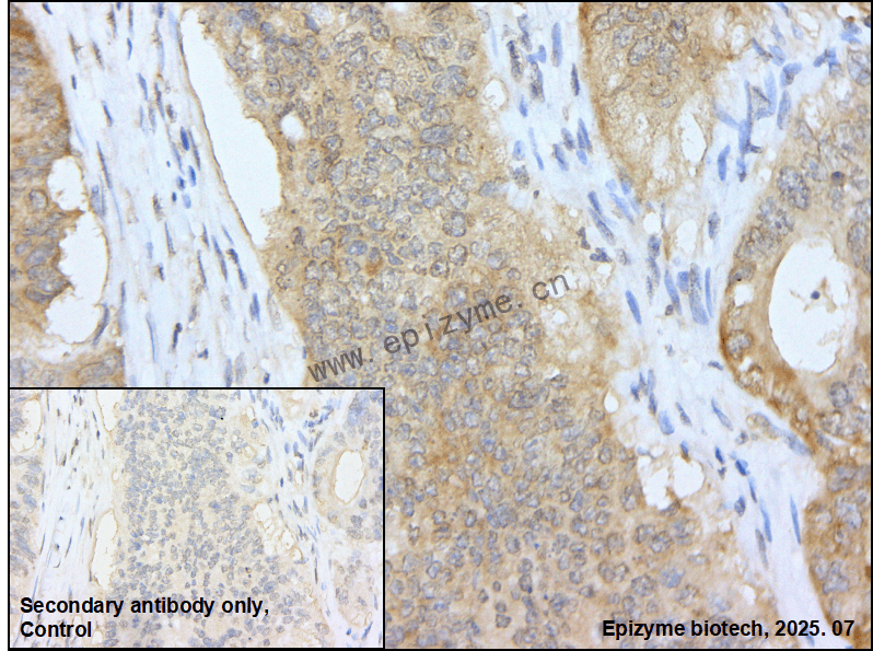 Anti-LINE 1 ORF1p Rabbit mAb [75K85K22]