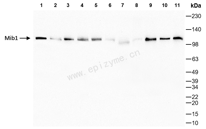 Anti-MIB1 Rabbit mAb [67K24L59]