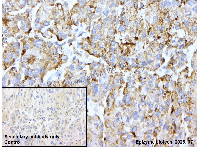Anti-MIB1 Rabbit mAb [67K24L59]