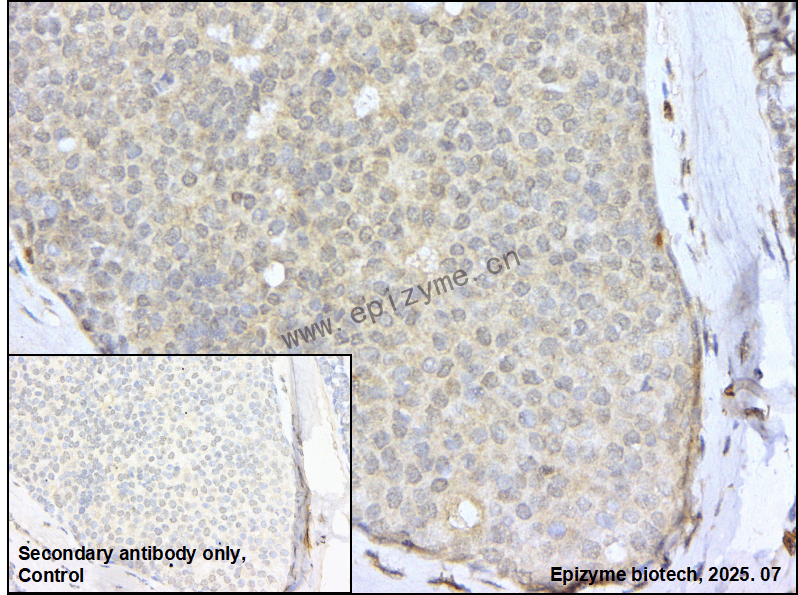 Anti-MIB1 Rabbit mAb [67K24L59]