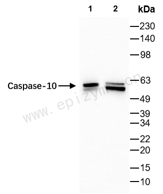 Anti-Caspase 10 Rabbit mAb [91K66K84]