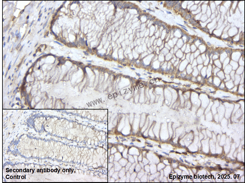 Anti-Caspase 10 Rabbit mAb [91K66K84]