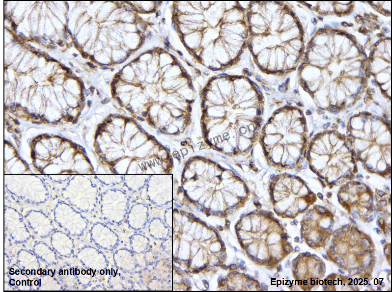 Anti-Caspase 10 Rabbit mAb [91K66K84]