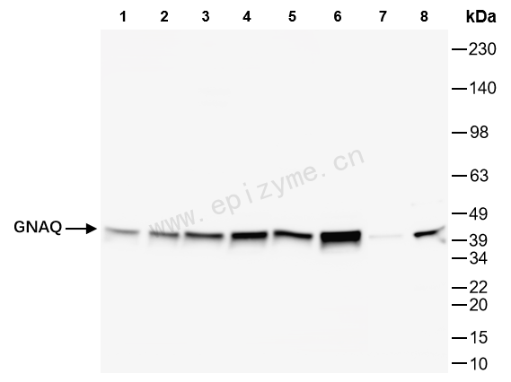 Anti-GNAQ Rabbit mAb [82L87L01]