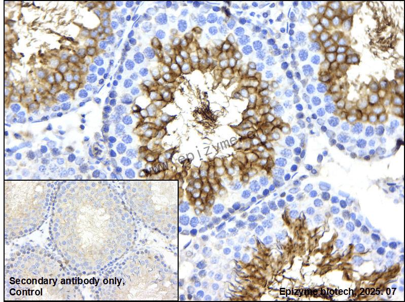 Anti-GNAQ Rabbit mAb [82L87L01]