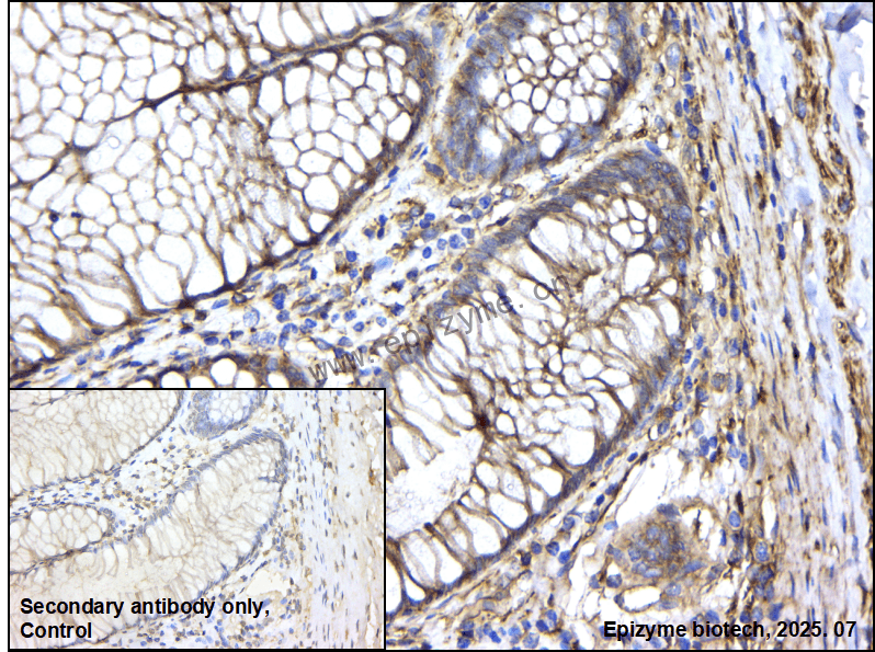 Anti-GNAQ Rabbit mAb [82L87L01]