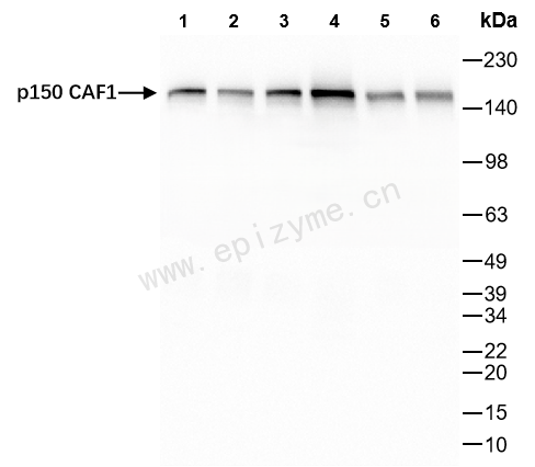 Anti-p150 CAF1 Rabbit mAb [66M33M11]