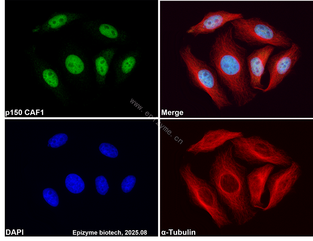 Anti-p150 CAF1 Rabbit mAb [66M33M11]