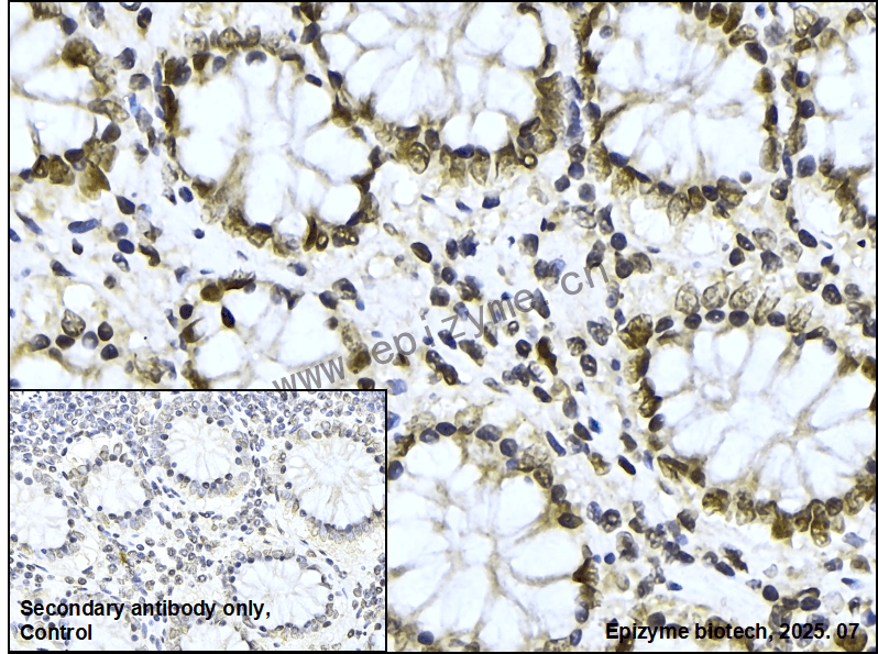 Anti-p150 CAF1 Rabbit mAb [66M33M11]