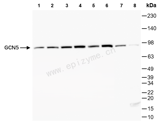 Anti-KAT2A Rabbit mAb [87M67M84]