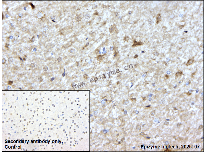 Anti-KAT2A Rabbit mAb [87M67M84]