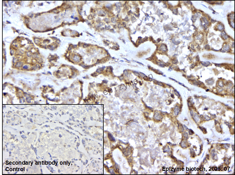 Anti-KAT2A Rabbit mAb [87M67M84]