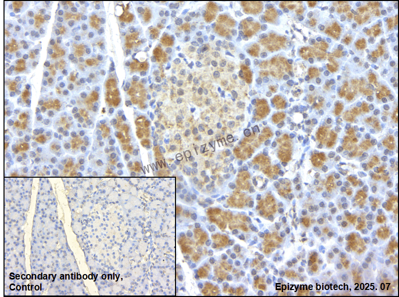 Anti-KAT2A Rabbit mAb [87M67M84]