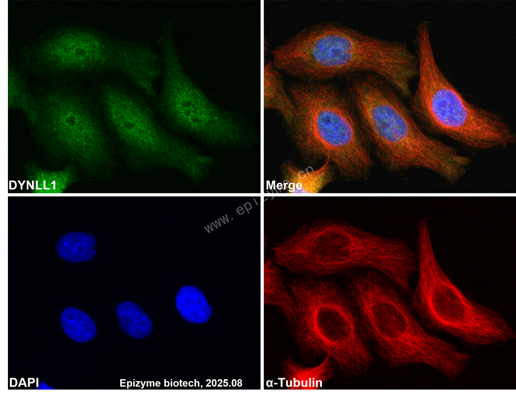 Anti-DYNLL1 Rabbit mAb [42K18L41]