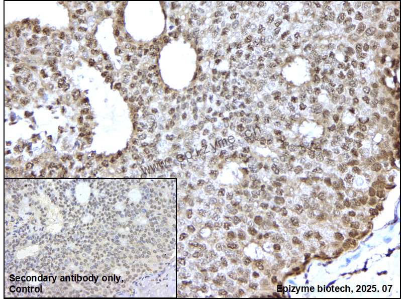 Anti-DYNLL1 Rabbit mAb [42K18L41]