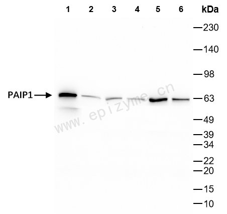 Anti-PAIP1 Rabbit mAb [49L02K52]