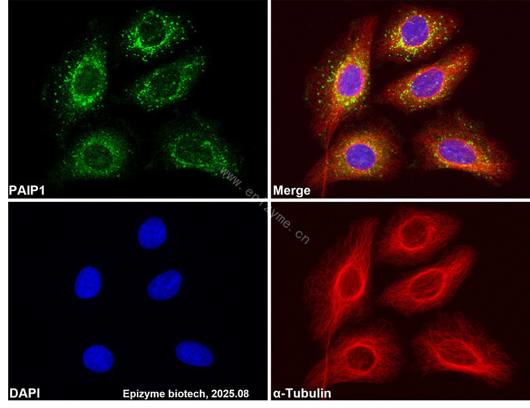 Anti-PAIP1 Rabbit mAb [49L02K52]
