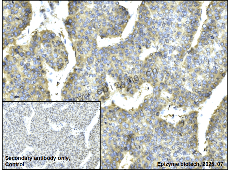 Anti-PAIP1 Rabbit mAb [49L02K52]