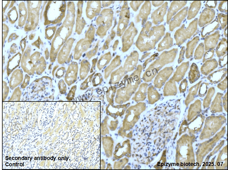 Anti-PAIP1 Rabbit mAb [49L02K52]