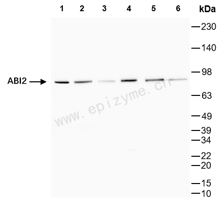 Anti-ABI2 Rabbit mAb [94D57I43]