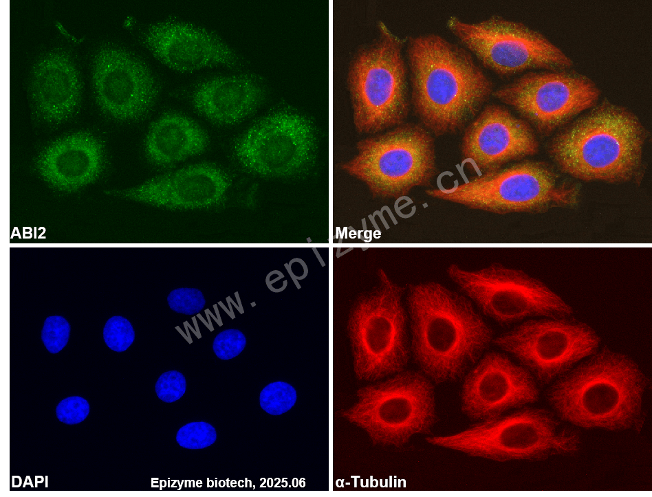 Anti-ABI2 Rabbit mAb [94D57I43]