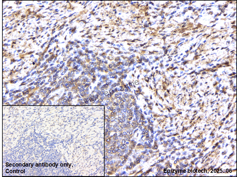 Anti-ABI2 Rabbit mAb [94D57I43]