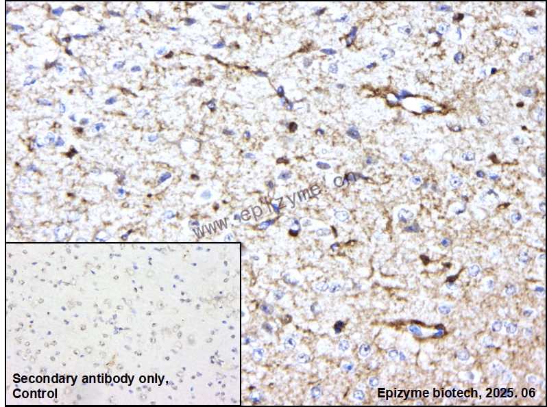 Anti-ABI2 Rabbit mAb [94D57I43]