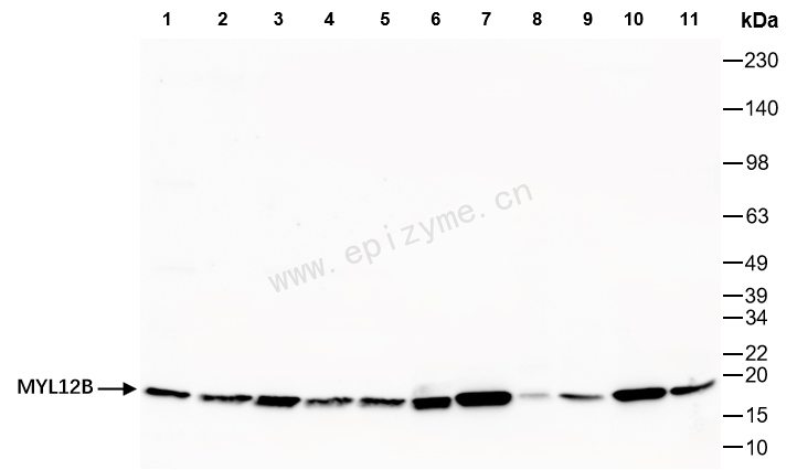Anti-MYL12B Rabbit mAb [42L66M52]