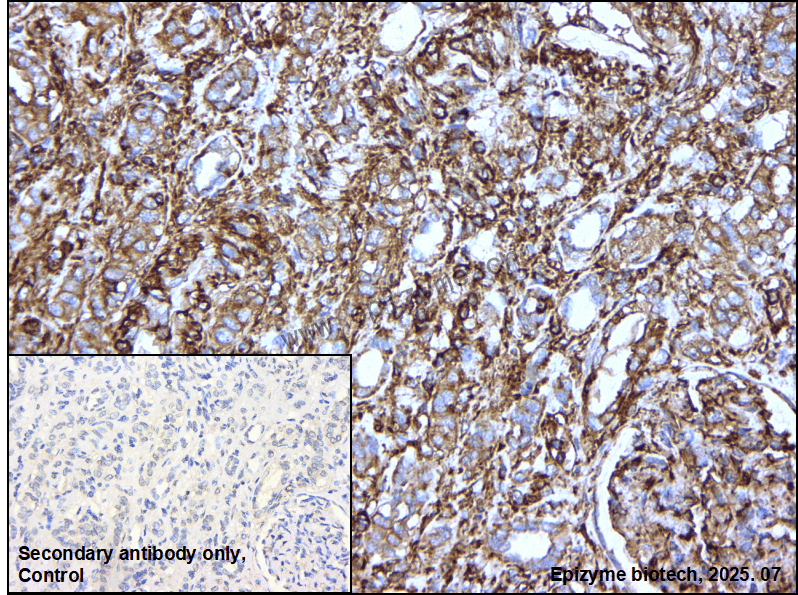 Anti-MYL12B Rabbit mAb [42L66M52]