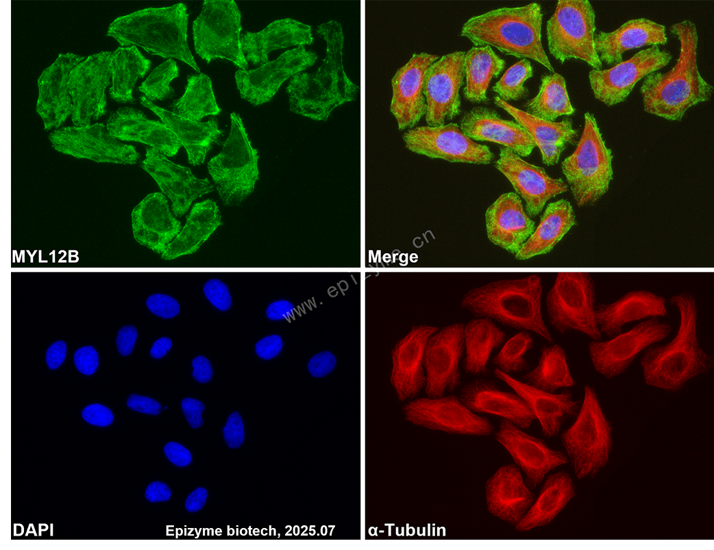 Anti-MYL12B Rabbit mAb [42L66M52]