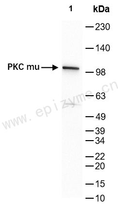 Anti-PKC mu Rabbit mAb [78I45C03]
