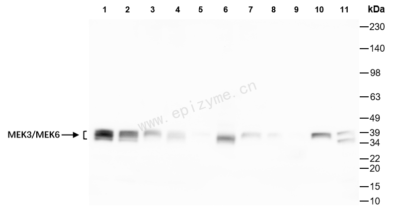 Anti-MEK3/MEK6 Rabbit mAb [94C58M33]