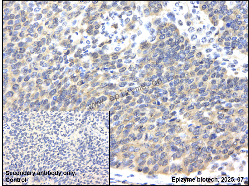 Anti-MEK3/MEK6 Rabbit mAb [94C58M33]
