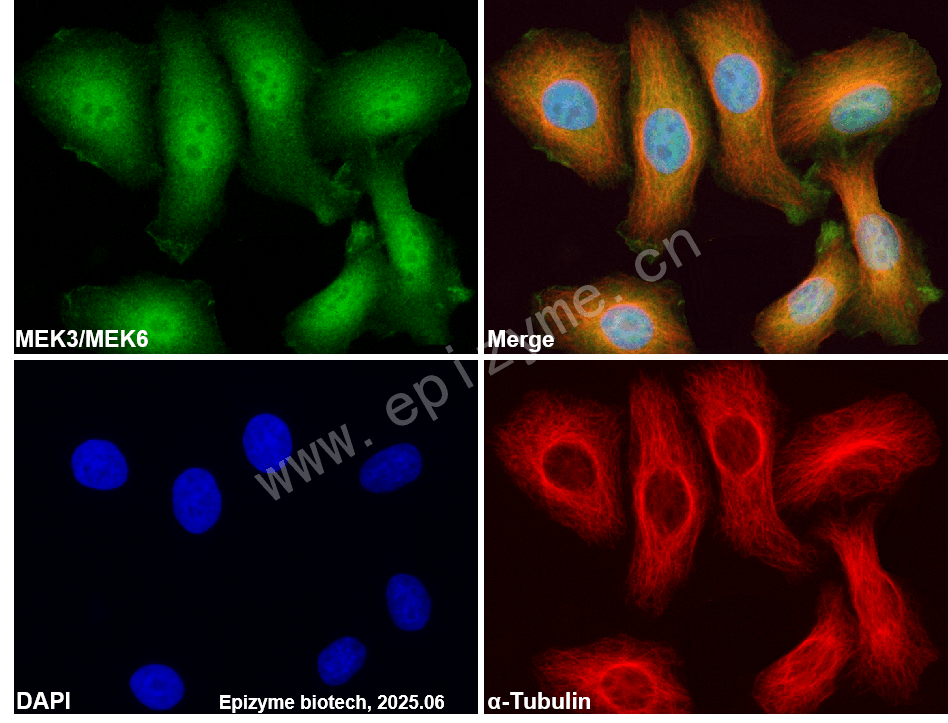 Anti-MEK3/MEK6 Rabbit mAb [94C58M33]