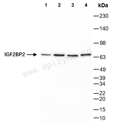 Anti-IGF2BP2 Rabbit mAb [56E20A95]
