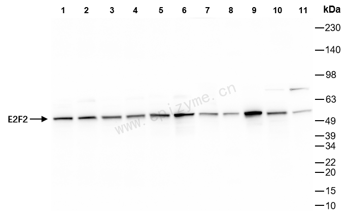 Anti-E2F2 Rabbit mAb [92A65F53]