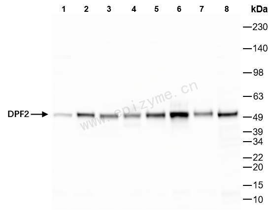 Anti-DPF2 Rabbit mAb [67S48A15]