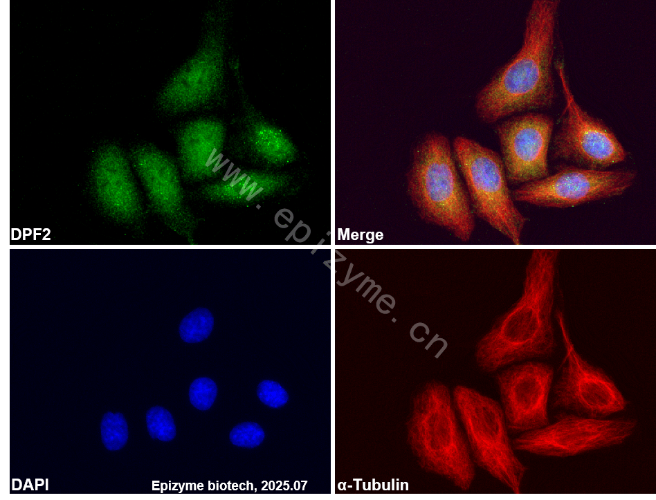Anti-DPF2 Rabbit mAb [67S48A15]