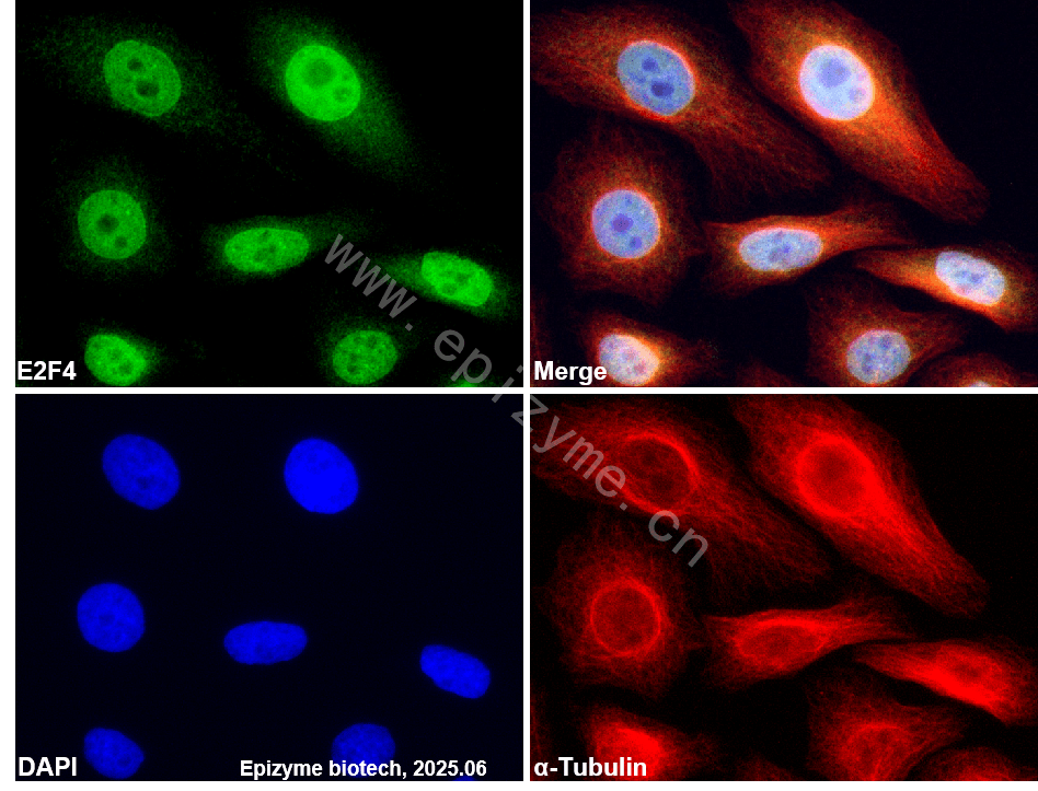 Anti-E2F4 Rabbit mAb [22B42S26]