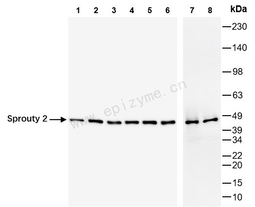 Anti-SPRY2 Rabbit mAb [13P83L78]