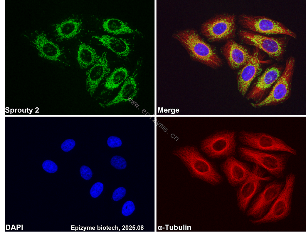Anti-SPRY2 Rabbit mAb [13P83L78]