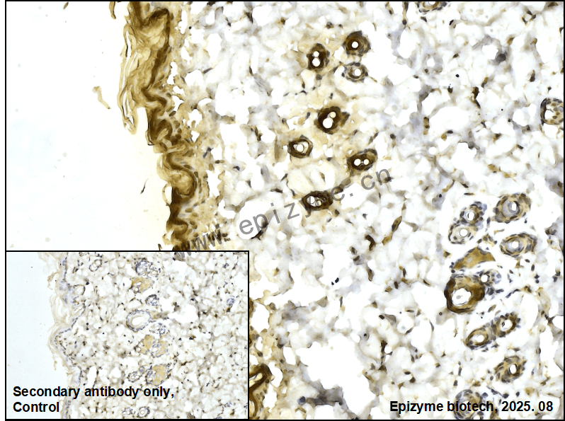 Anti-SPRY2 Rabbit mAb [13P83L78]
